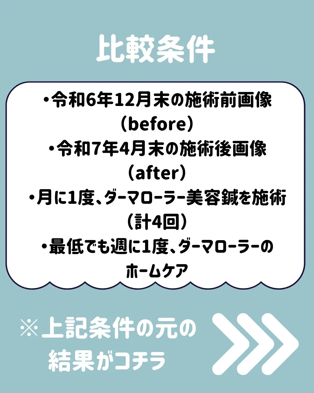 🌟 ダーマローラーと美容鍼の4回コースモニター体験についてシ...
