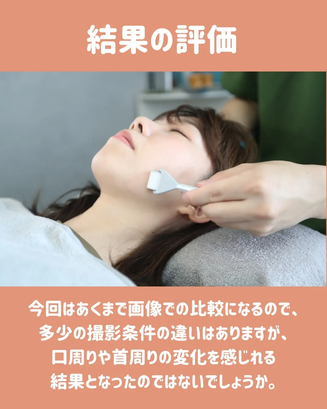 🌟 ダーマローラーと美容鍼の4回コースモニター体験についてシ...